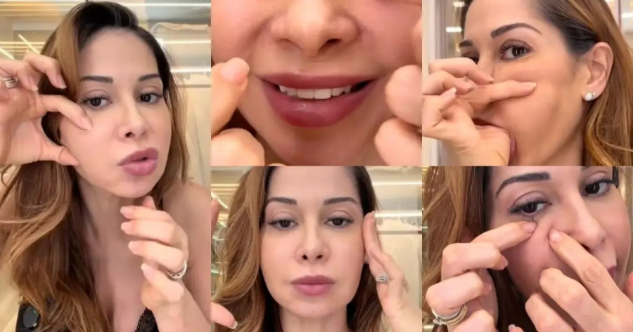 Maíra Cardi terá que fazer cirurgia no rosto por risco de necrose: 